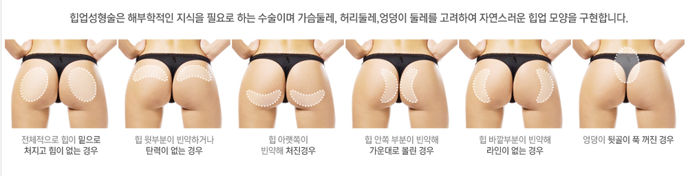 http://www.ezday.co.kr/bbs/view_board.html?q_sq_board=6431871 힙업수술후기 힙업수술비용 힙업수술가격 힙업수술사진 엉덩이힙업수술 ...