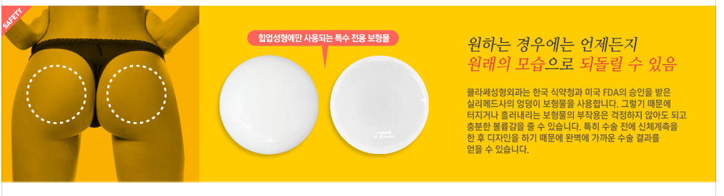 힙업수술후기 힙업수술비용 힙업수술가격 힙업수술사진 엉덩이힙업수술 ...