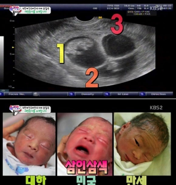 ¿ ǻ . ¿ ǻ簡 ۵  ް ִ. ¿ ǻ ۿ    ä õ ̴. /KBS2 '۸ ƿԴ' ȭ ĸó