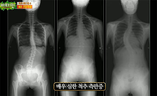 ����� �ٰ�ݰ� ���� ����, ���� ���� �ڼ� ����. ����� �ٰ�ݰ� ���� ������ 9�� �˻�â �ϴܿ� ������ ��Ƽ����� ������ �ް� �ִ�. ����� �ٰ�ݰ� ���� ������ �� �� ��� �� �ɰ��� ���ۿ��� ���� �� �ִ� ������ �˷�����. / KBS2 '��Ÿ��' ��� ȭ�� ĸó