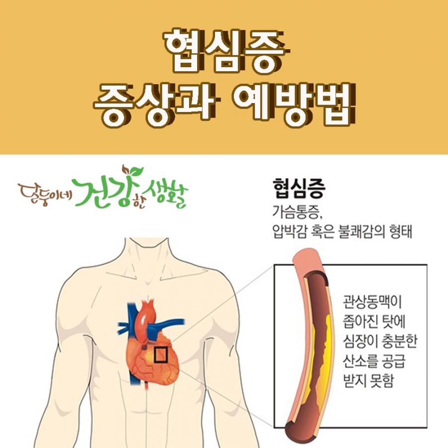 협심증 증상과 예방법 0173