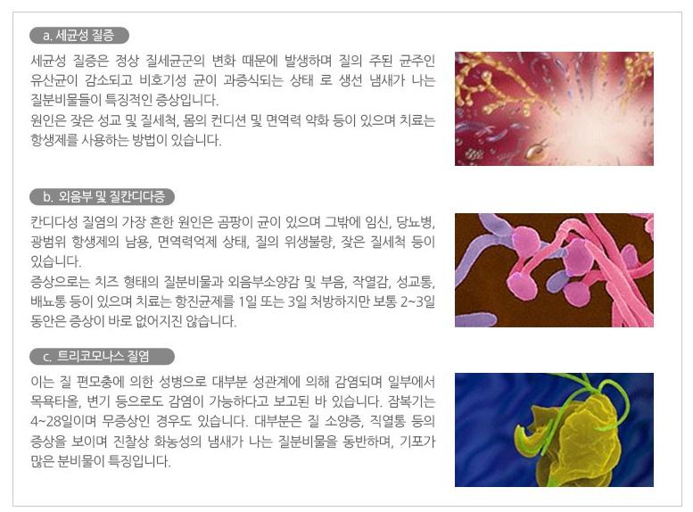 지앤산부인과가 자랑하는 산부인과질염 치료! 